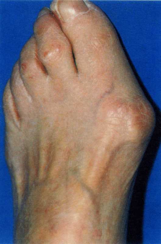 Foot conditions podiatry