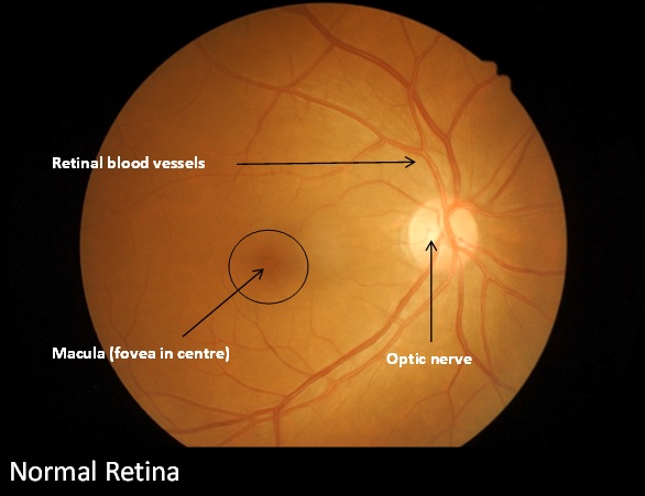 Normal retina