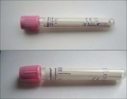 Pink top blood sample bottle with label