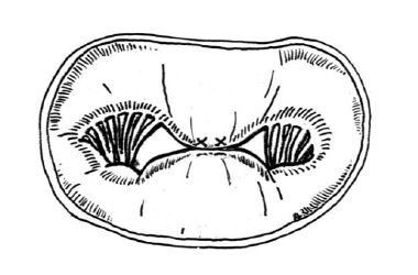Line diagram of the miral vlave pulled together