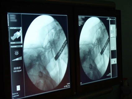 Endoscopy x-ray on screens