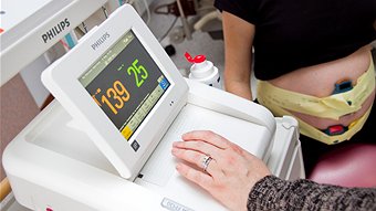 A pregnant woman is attached to a machine monitoring baby's heart rate and contractions.