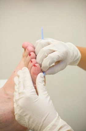 Foot getting podiatry treatment