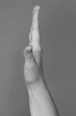 Hand with straight fingers