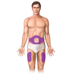 Ilustration highlighting the two areas you can give a subcutaneous injection. The abdomen area and either thigh. 