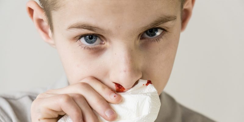 A young person holding a tissue against their nose as they have a nosebleed