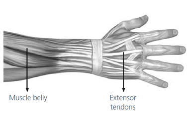 Medical illustration of the hand and wrist tendons - looking downwards to the top of the hand