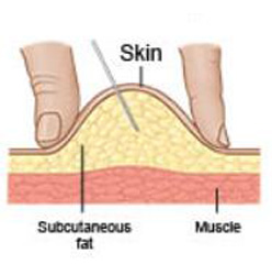 Diagram of the skin, showing the fat and muscle beneath