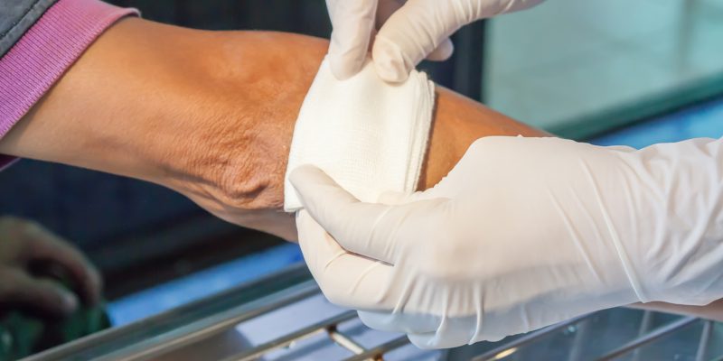 Image showing a persons arm being dressed with a bandage or gauze material.