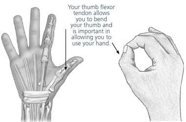 2 illustrations, 1 showing the thumb flexor tendon, the other of how we use the hand when bending your fingers and thumb