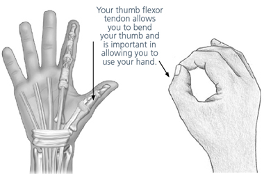 Advice and exercises following your thumb flexor tendon repair