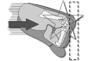 Diagram showing a fist punching which highlights the knuckle where the impact and injury would occur