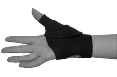 Hand wearing a splint