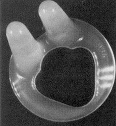 example of a flexible ring device