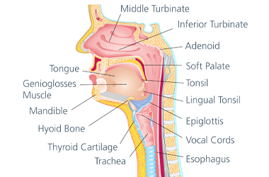 lingual tonsil cancer symptoms