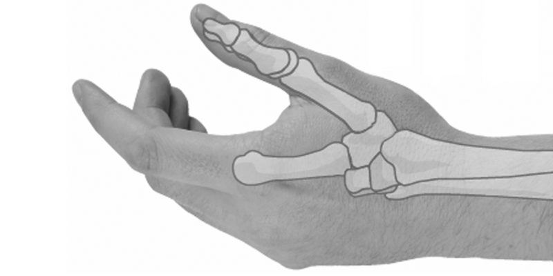 A image of the hand and wrist with a drawing over the top of the thumb and first finger illustrating where the joints are