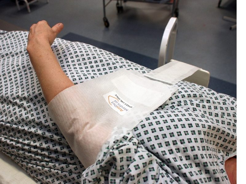 A patient wearing a hospital gown, laying on a hospital bed wearing a white Amdel Medical Sling on their left arm.