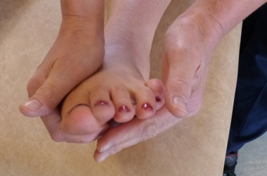 Foot is gently pressed to turn outwards