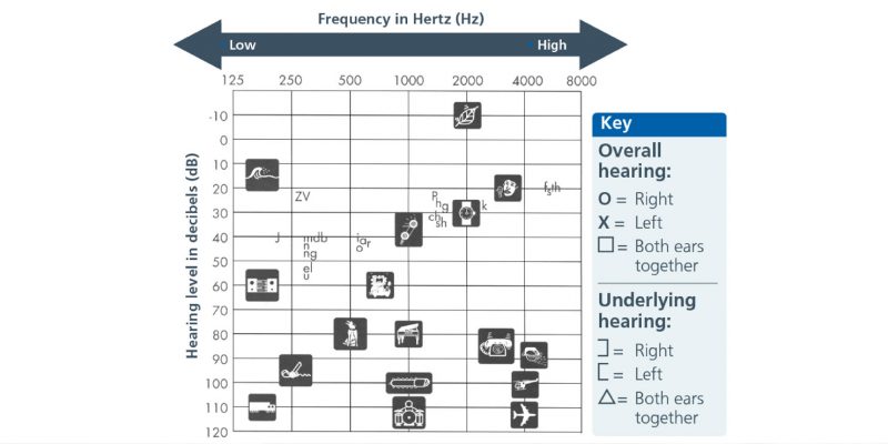 Frequency table