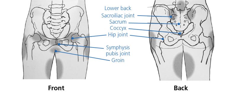 Pelvic girdle pain (PGP) in pregnancy - South Tees Hospitals NHS Foundation  Trust