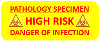 label for high risk pathology specimen