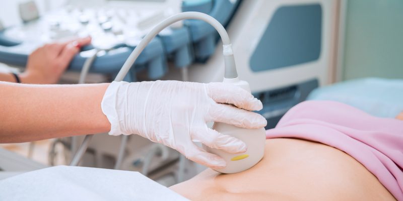 Sonographer performing an ultrasound scan 