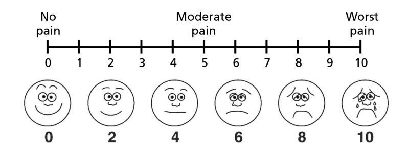 Pain scale from 1 to 10.
1 means no pain, 4 to 5 is moderate pain and 9 to 10 is the worst pain.