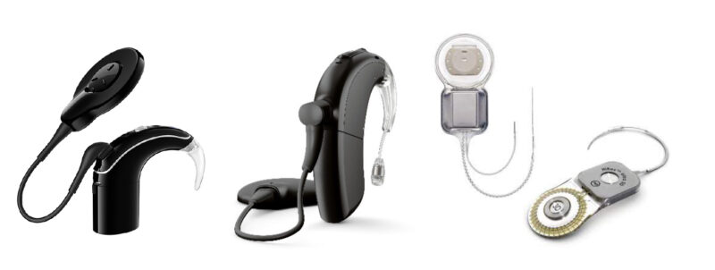 Examples of various cochlear implants