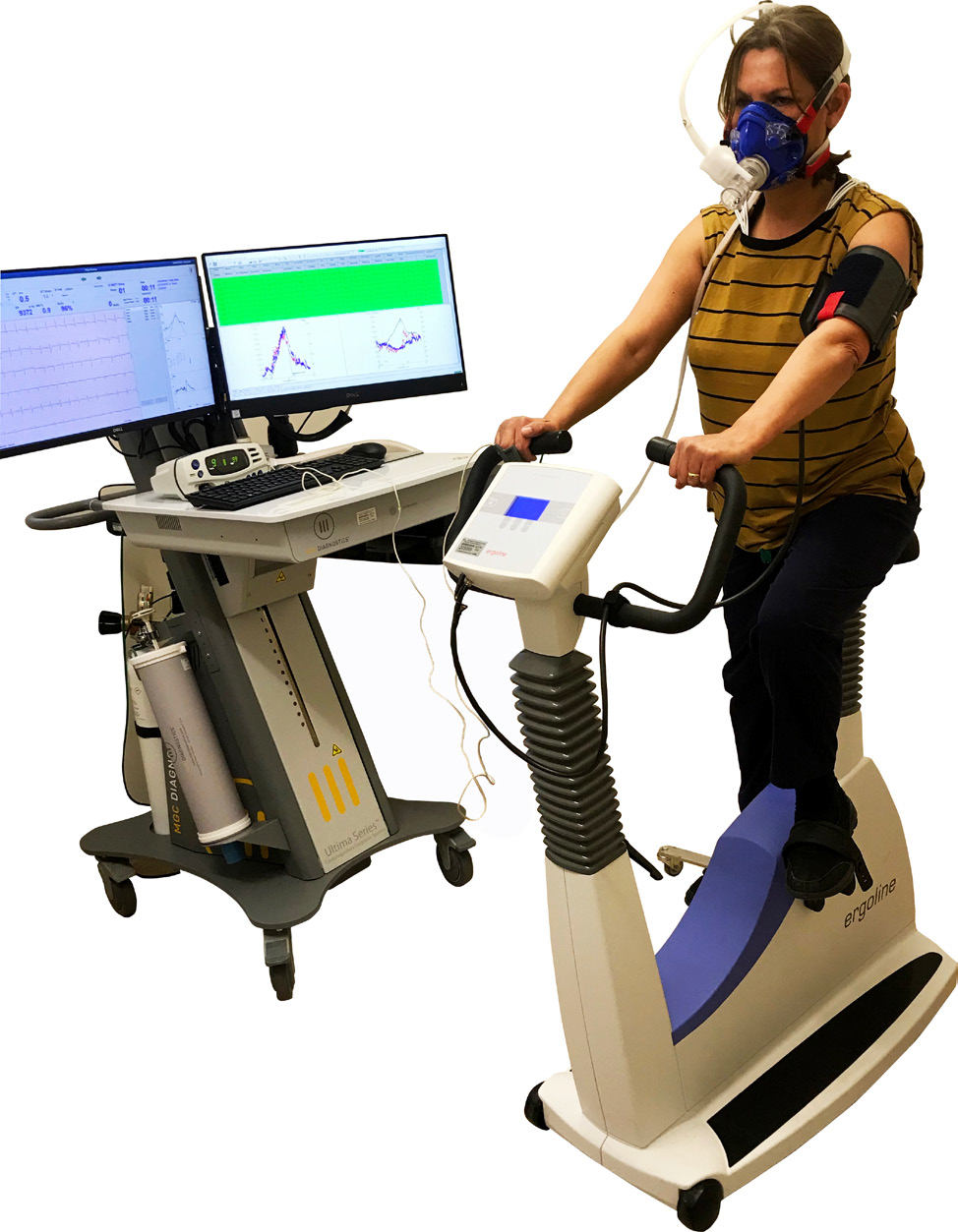 Cardiopulmonary exercise testing South Tees Hospitals NHS Foundation