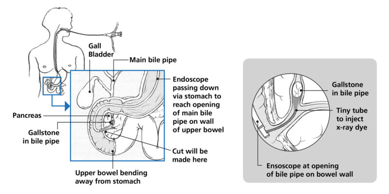 Diagram highlighting the different areas the endoscope passes on its journey into the stomach