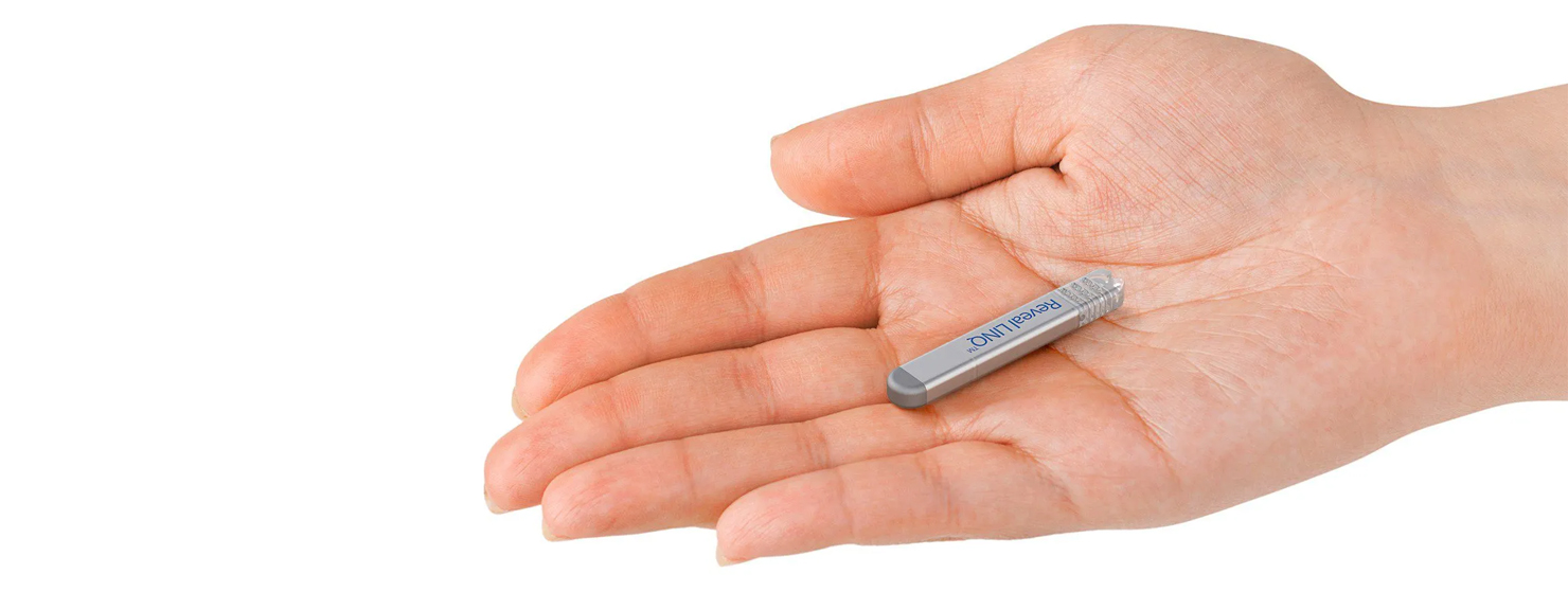 Implantable Cardiac Monitors - South Tees Hospitals NHS Foundation Trust