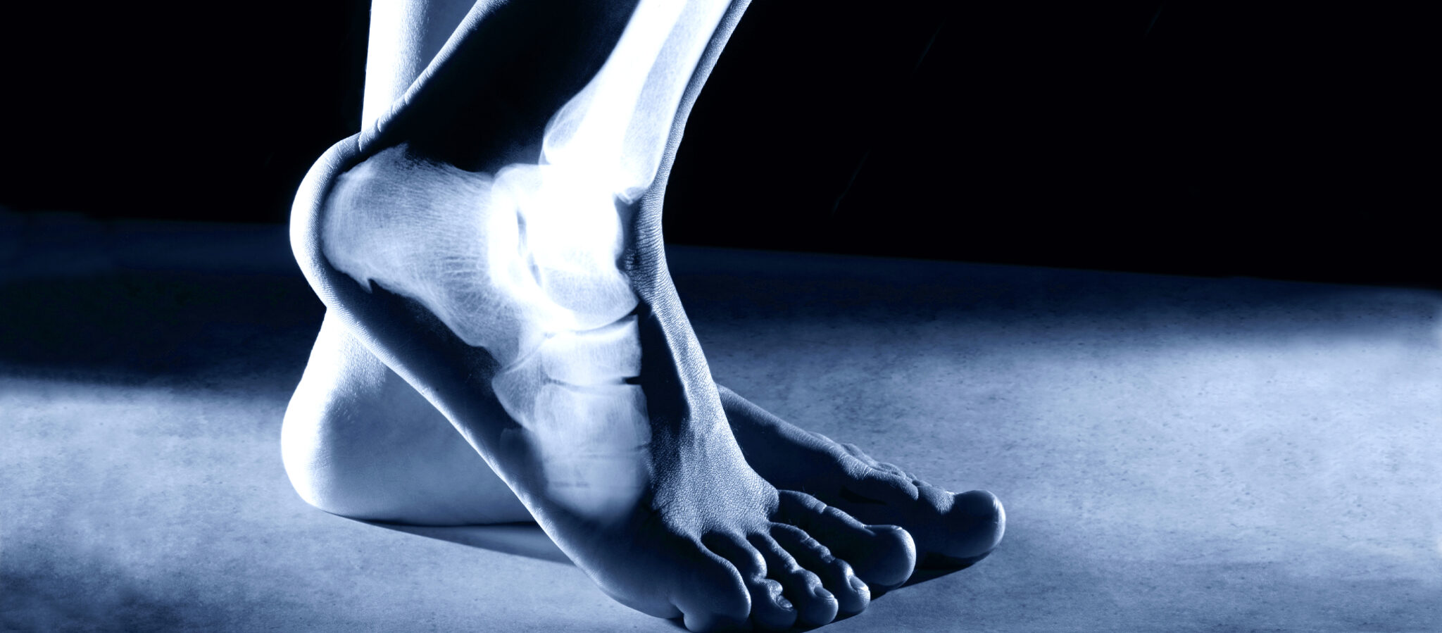 Preparing for foot and ankle surgery - South Tees Hospitals NHS ...