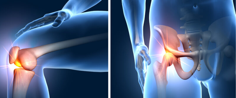 illustration of knee and hip joints