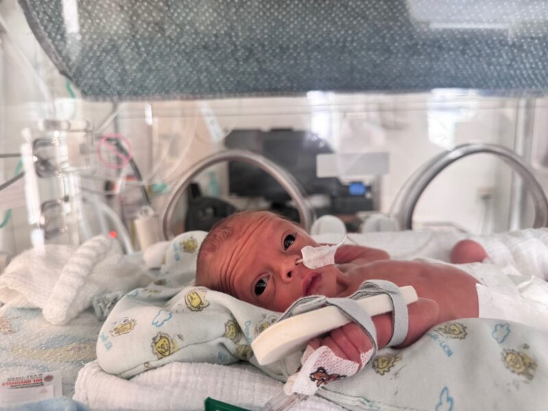 Jude in a incubator in the neonatal unit