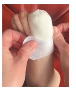 Image showing how to apply tape to hold the dressing in place.