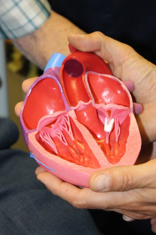 Model of the clip used during the mitral transcatheter edge-to-edge repair