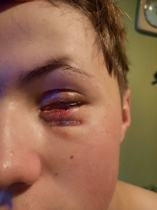 Aleks during his recovery
