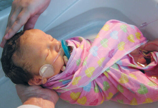 Neonatal baby