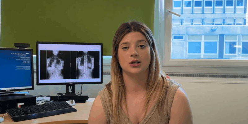 Maisie scoliosis patient