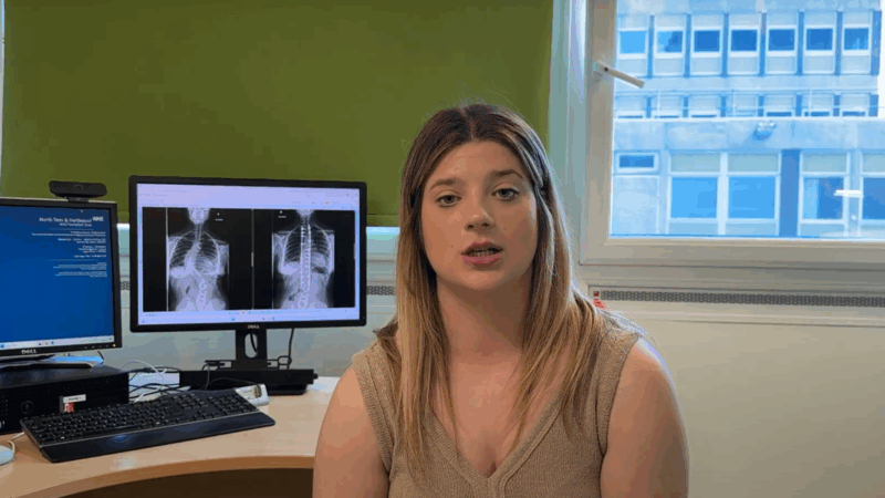 Maisie scoliosis patient